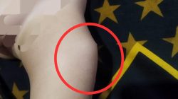 Balita di Kabupaten Bandung Diduga Alami Reaksi Pasca Imunisasi, Keluarga Pertanyakan Prosedur Puskesmas