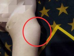 Balita di Kabupaten Bandung Diduga Alami Reaksi Pasca Imunisasi, Keluarga Pertanyakan Prosedur Puskesmas